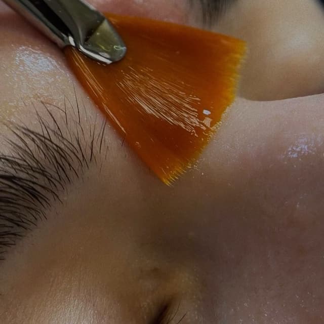 Glycolic Peel Series (4 Treatments) at Kallara Beauty in Oswego, IL